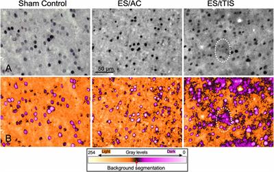 Comparing the effects of transcranial alternating current and temporal interference (tTIS) electric stimulation through whole-brain mapping of c-Fos immunoreactivity